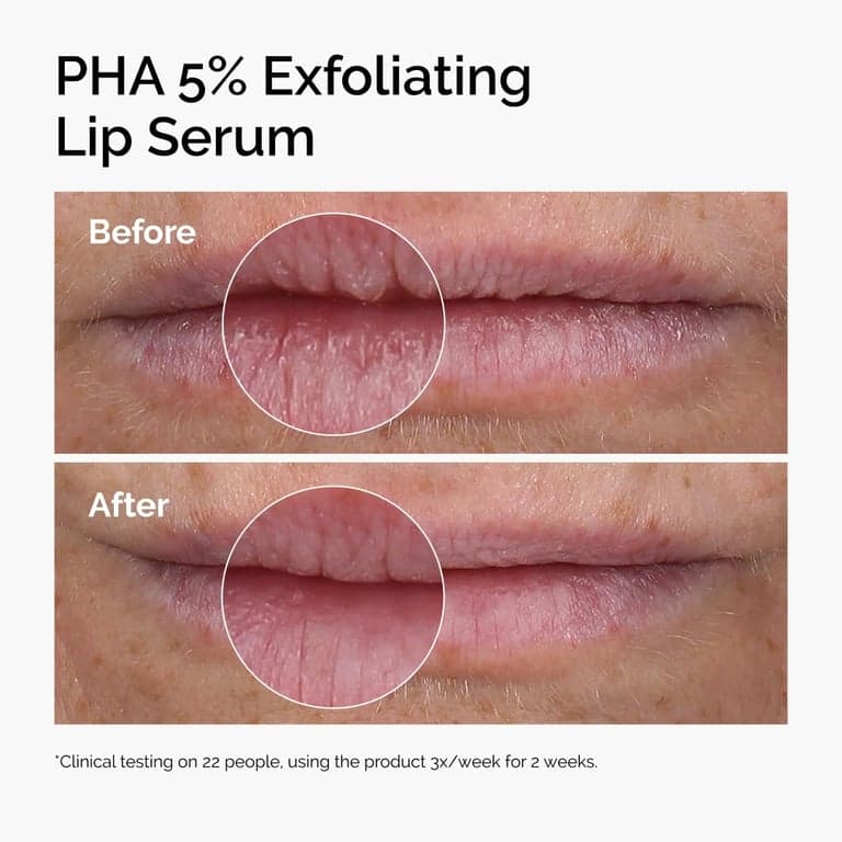 The Ordinary Lip Care Duo - Set de Cuidado de Labios - Suero Exfoliante Labial PHA 5% 0.5 Fl Oz + Bálsamo de Escualano y Aminoácidos - imagen 3